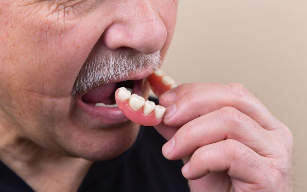 Photo dental implant, dairy